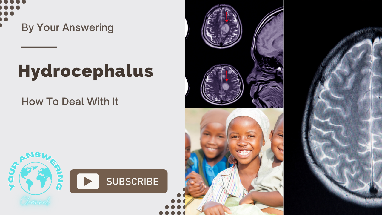 Hydrocephalus in Kids and its Treatment
